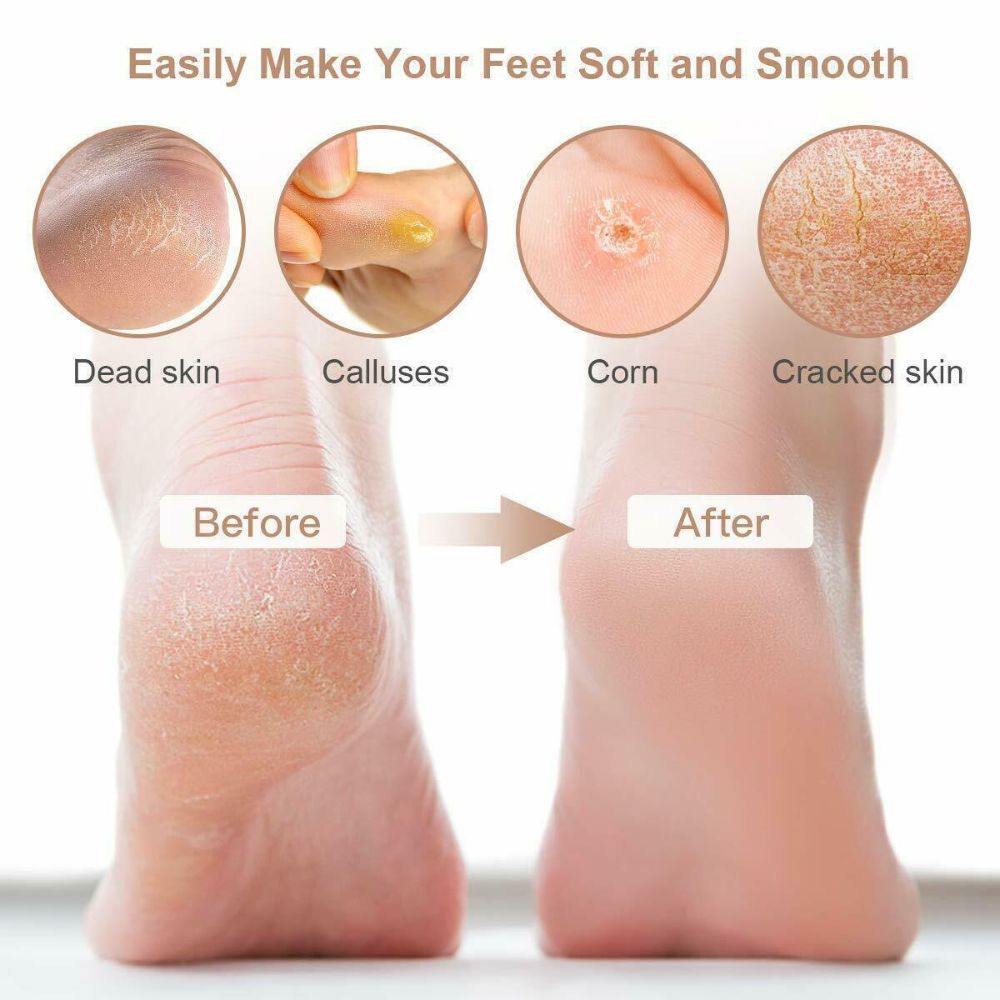 Electric Care Pedicure Foot File Hard Dead Remover Foot Grinder Skin Callus