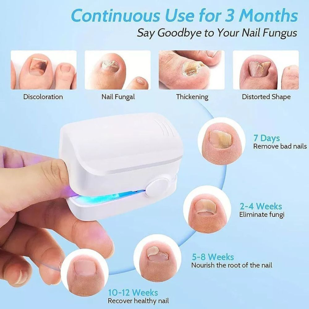 Nail Fungus Removal Therapy Device Treatment Cleaning Laser Toenail Fingernail