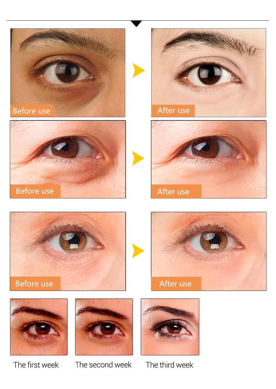 Pink Collagen Under Eye Patches Hyaluronic Acid Anti Ageing Vitamin C