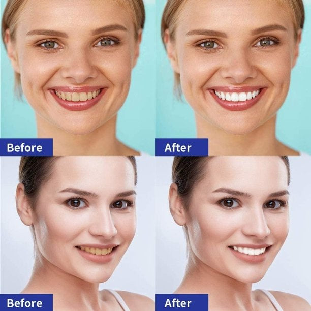 5D TEETH WHITENING STRIPS PRO SAFE WHITE TOOTH CLEAN GEL BLEACH DENTAL STRENGTH
