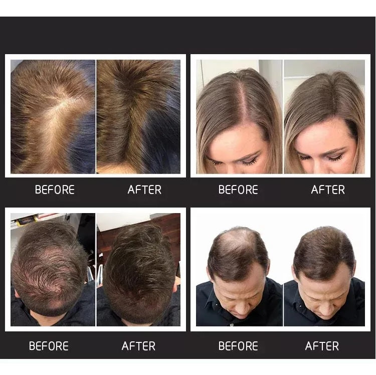 TOPPIK Hair Loss Building Fibers 27.5g Alopecia Keratin Thicker Concealer Fiber