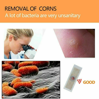 Foot Corn Remover Pads Plantar Wart Thorn Plaster Patch Callus Removal